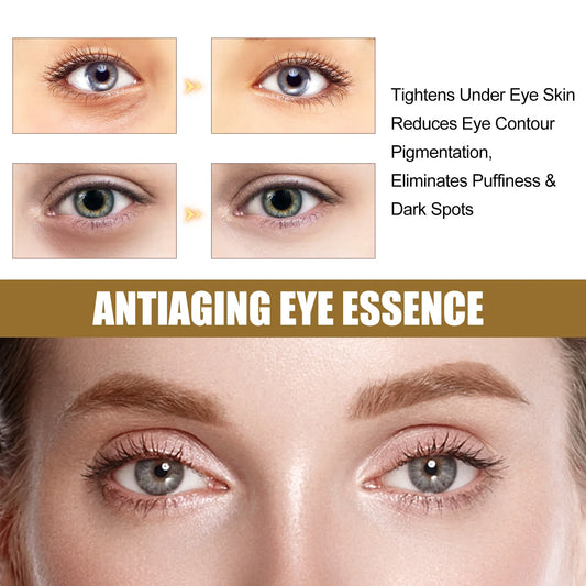 Eelhoe Anti-aging Eye Serum Removes Eye Bags Reduces Pores and Fine Lines Lighens Wrinkles and Dark Circles Eye Care Essence
