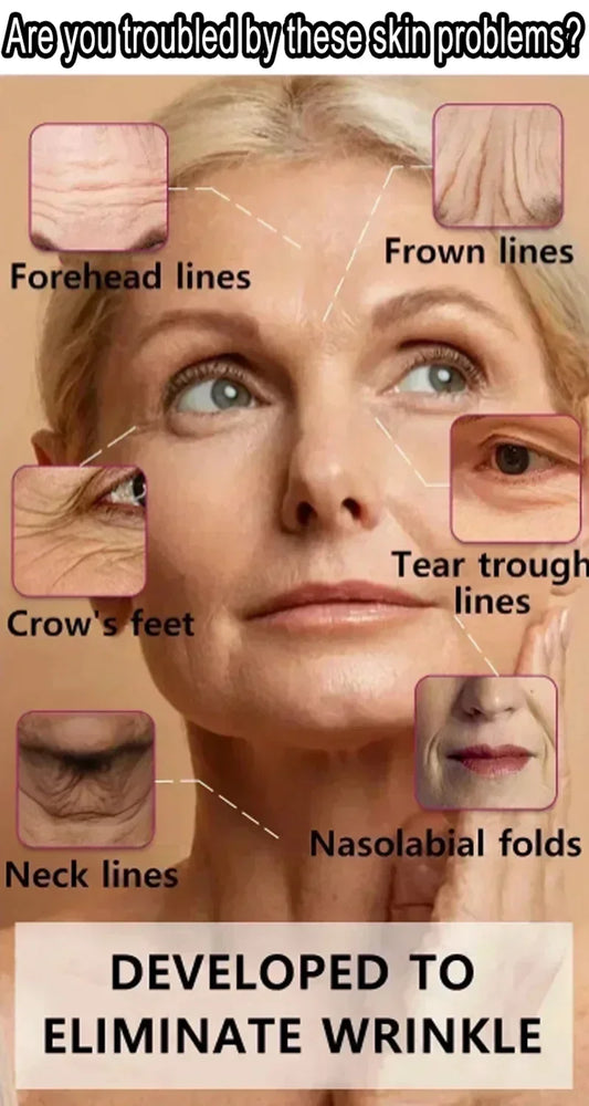 Facial fine lines and crow’s feet treatment