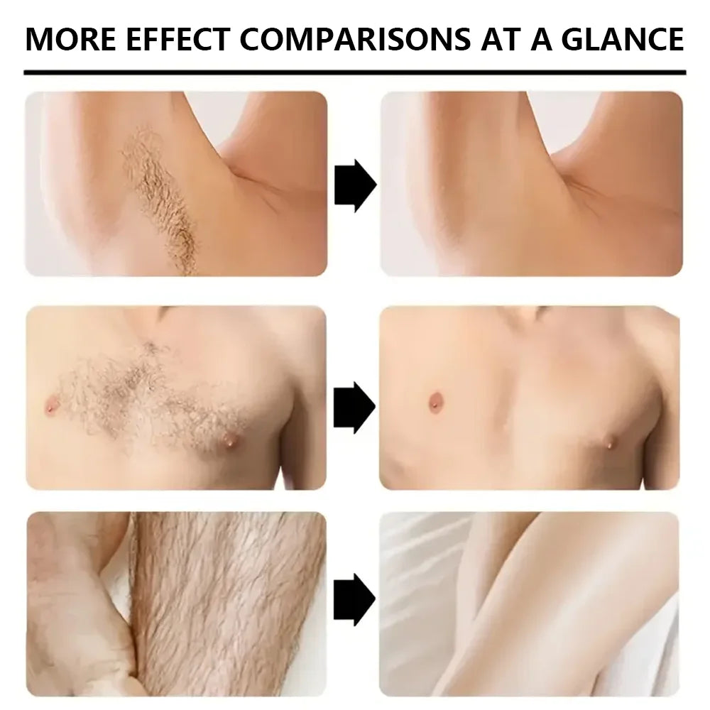 YUITIKUE Hair Removal Cream, non-irritating, inhibits growth, smooth and portable, unisex body care product