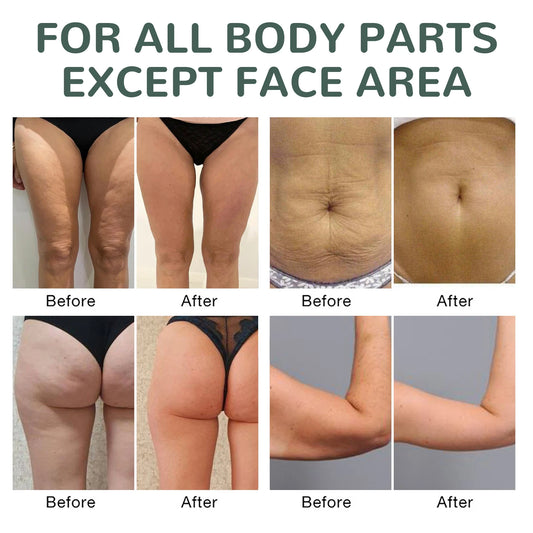 Collagen Firming Body Oil Deep Hydration Moisturizing Firming Arm Belly & Excess Fat Whole Body Skin Massage Essential Oil 100ml