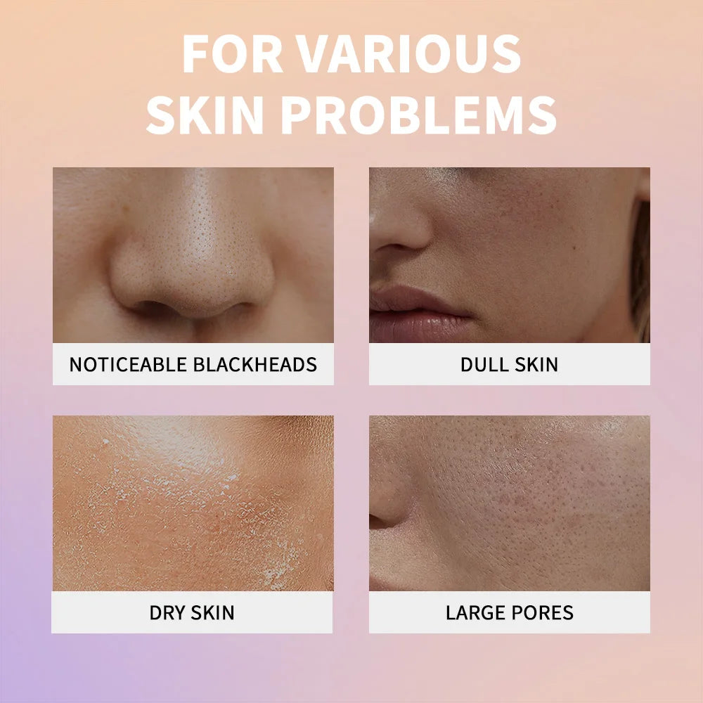 Lakrain Rice Peeling Ampoule Soft Exfoliating Face and Body Scrub Dead Skin Cells Blackhead Remover for All Skin Types  korean skin care