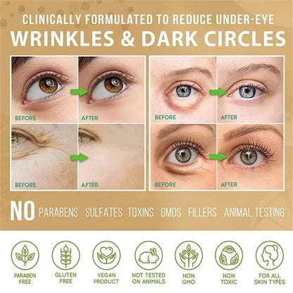 Hoygi Eye Fat Granules Removal Eyestick Anti-Puffiness Firming Cream Anti Inflammatory Fade Fine Line Repair Skin Barrier Skin Care