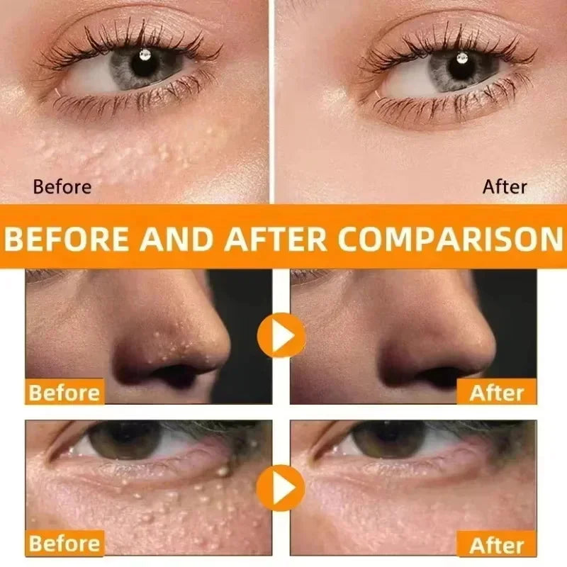 Hoygi Eye Fat Granules Removal Eyestick Anti-Puffiness Firming Cream Anti Inflammatory Fade Fine Line Repair Skin Barrier Skin Care