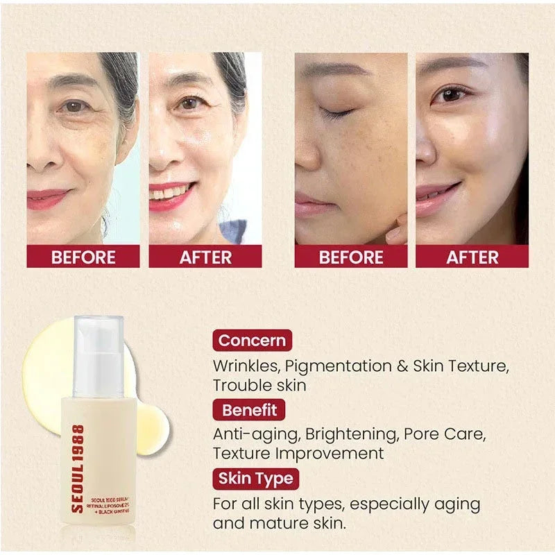 Seoul 1988 Retinal Liposome Face Cream,Snail Mucin Essence Rice Moisturizing Soothing Toner,Retinol Eye Serum,Korean Skincare