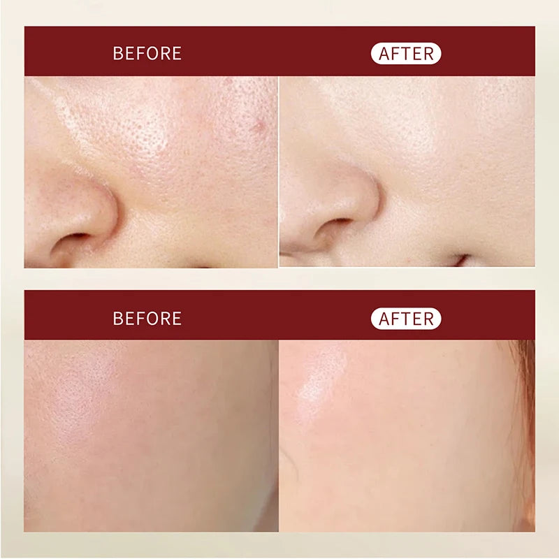 Hoygi Peel Shot Ampule Set Rice Toner Moisturizing Facial Essence Glowing Skin Water-oil Balancing Essence Revitalizing Skin Dullness