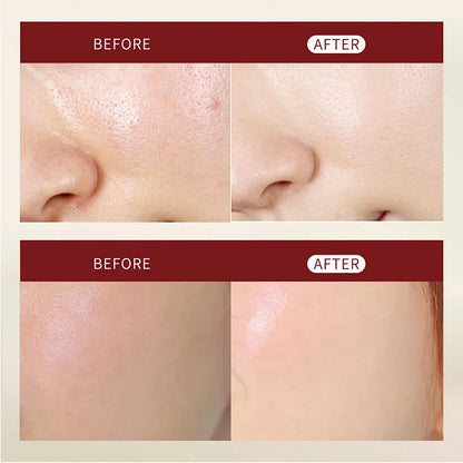 Hoygi Peel Shot Ampule Set Rice Toner Moisturizing Facial Essence Glowing Skin Water-oil Balancing Essence Revitalizing Skin Dullness