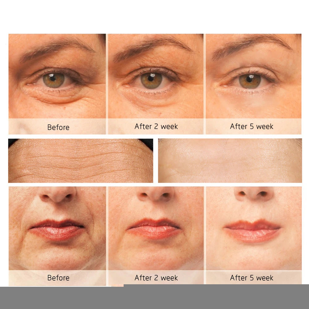 Mini Electric Vibration Eye Massager Anti-Ageing Wrinkle Dark Circle Pen Removal Rejuvenation Eye Massager