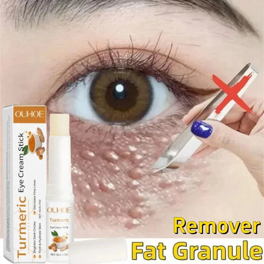Hoygi Eye Fat Granules Removal Eyestick Anti-Puffiness Firming Cream Anti Inflammatory Fade Fine Line Repair Skin Barrier Skin Care