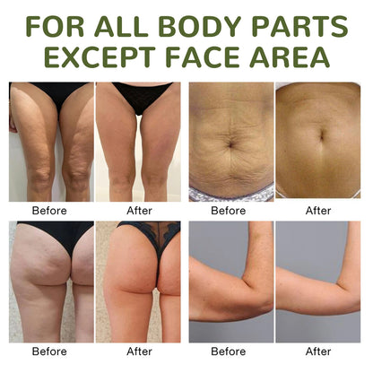 Lifting Body Oil Anti-Cellulite Tightening Firming Stomach Thigh Arm Prevent Sagging Nourishing Hydrating Massage Essential Oil