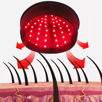 96Pcs Leds 660nm&850nm Red&Infrared Light Therapy Hair Growth Cap for Hair Regrowth Anti Hair Loss Relax Scalp Oil Control Hat