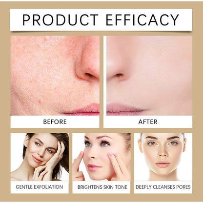 Hoygi Peel Shot Ampule Set Rice Toner Moisturizing Facial Essence Glowing Skin Water-oil Balancing Essence Revitalizing Skin Dullness
