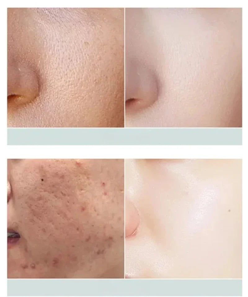 OUHOE White Black Rice Exfoliating Serum Peel Shot Facial Moisturizing Soften Blackhead Removal Hydrating Shrink Pores Skin Care Korea