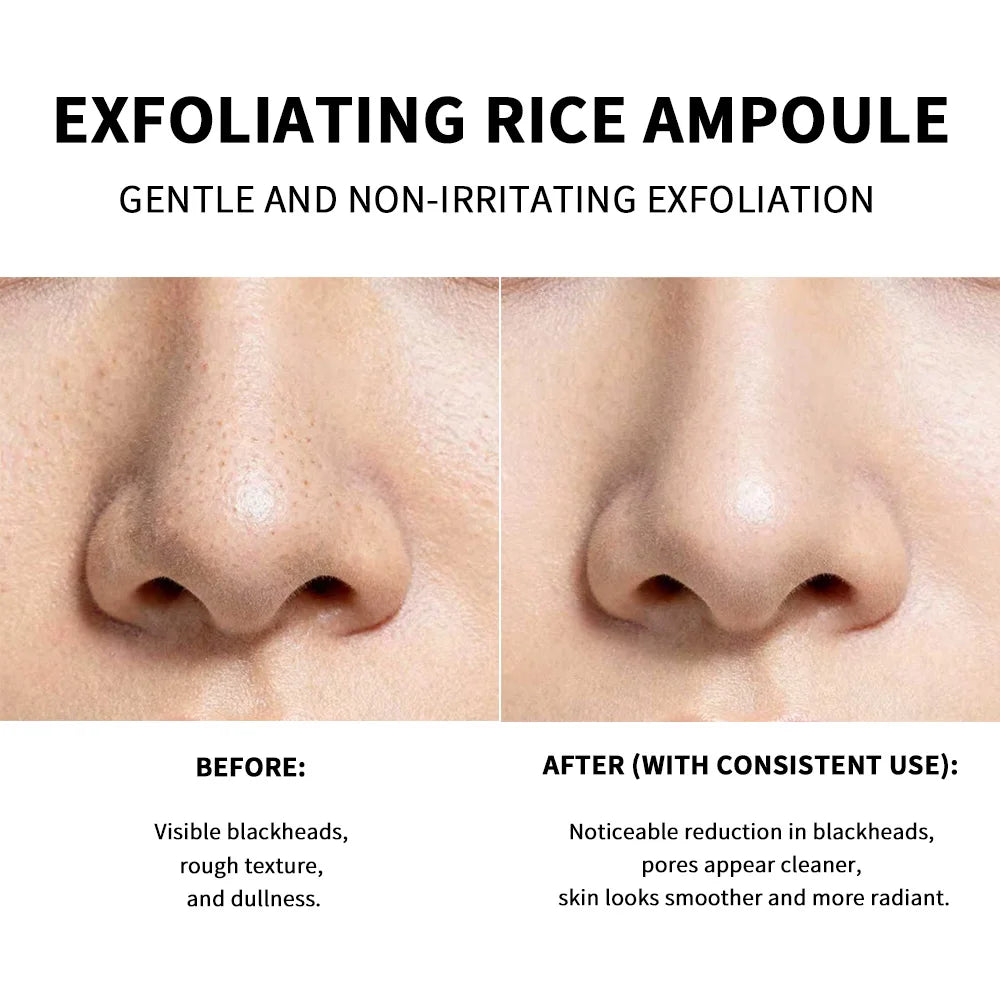 Lakrain Rice Peeling Ampoule Soft Exfoliating Face and Body Scrub Dead Skin Cells Blackhead Remover for All Skin Types  korean skin care