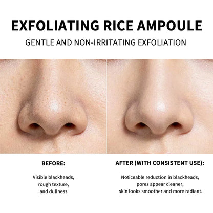 Lakrain Rice Peeling Ampoule Soft Exfoliating Face and Body Scrub Dead Skin Cells Blackhead Remover for All Skin Types  korean skin care