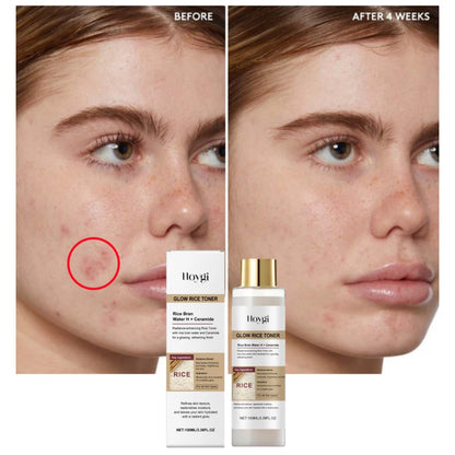 Hoygi Peel Shot Ampule Set Rice Toner Moisturizing Facial Essence Glowing Skin Water-oil Balancing Essence Revitalizing Skin Dullness