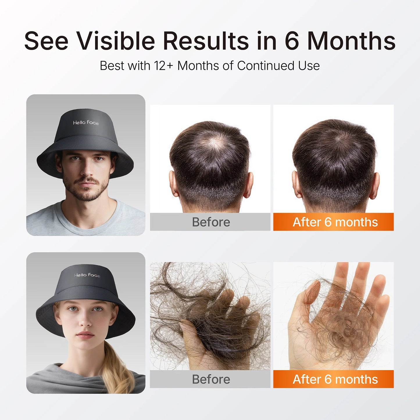 New Bucket Hat Hello Face 336 Pcs LED Hat Helmet Hair Growth Cap for Hair Loss Red Light 660nm Infrared Light 850nm Hair care