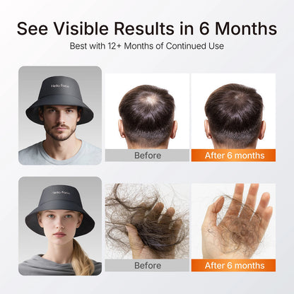 New Bucket Hat Hello Face 336 Pcs LED Hat Helmet Hair Growth Cap for Hair Loss Red Light 660nm Infrared Light 850nm Hair care