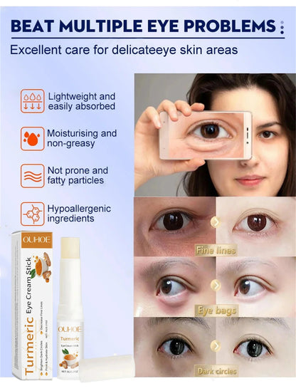 Hoygi Eye Fat Granules Removal Eyestick Anti-Puffiness Firming Cream Anti Inflammatory Fade Fine Line Repair Skin Barrier Skin Care