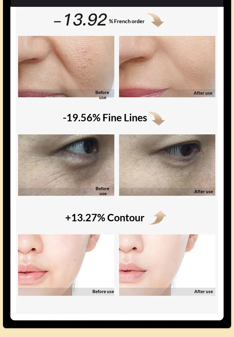RF Facial Beauty Device EMS Anti-Aging Wrinkle Remover 2 Colors LED Skin Care Mini Radio Frequency Face Massager
