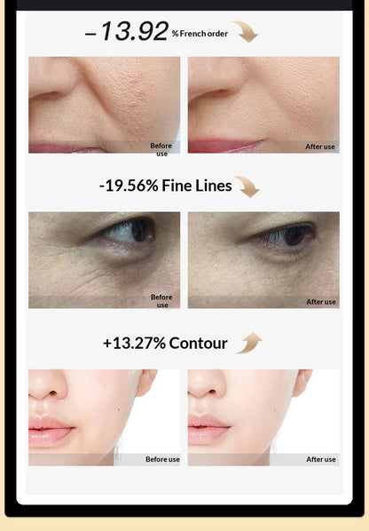 RF Facial Beauty Device EMS Anti-Aging Wrinkle Remover 2 Colors LED Skin Care Mini Radio Frequency Face Massager