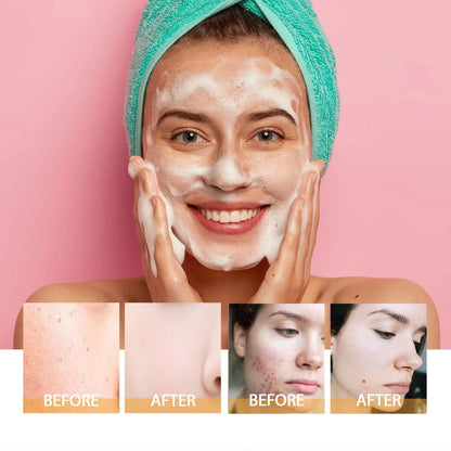 Turmeric Cleanser Face Wash Kojic Acid Exfoliating Deeply Cleanses Skin Maintains Water Oil Balance Remove Dirt Oil Control