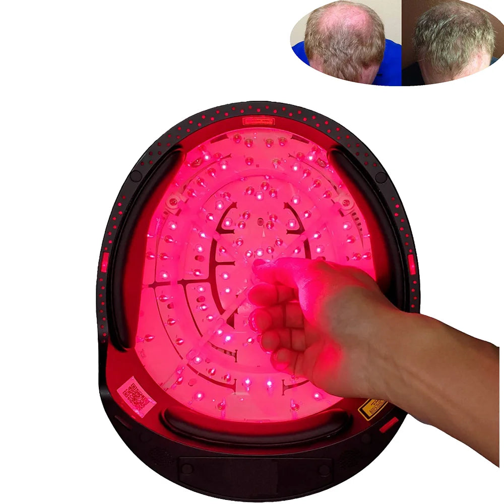 CE Approved Kernel KN-8000B Red Light Therapy Laser Hair Growth Cap Helmet For Hair Restoration