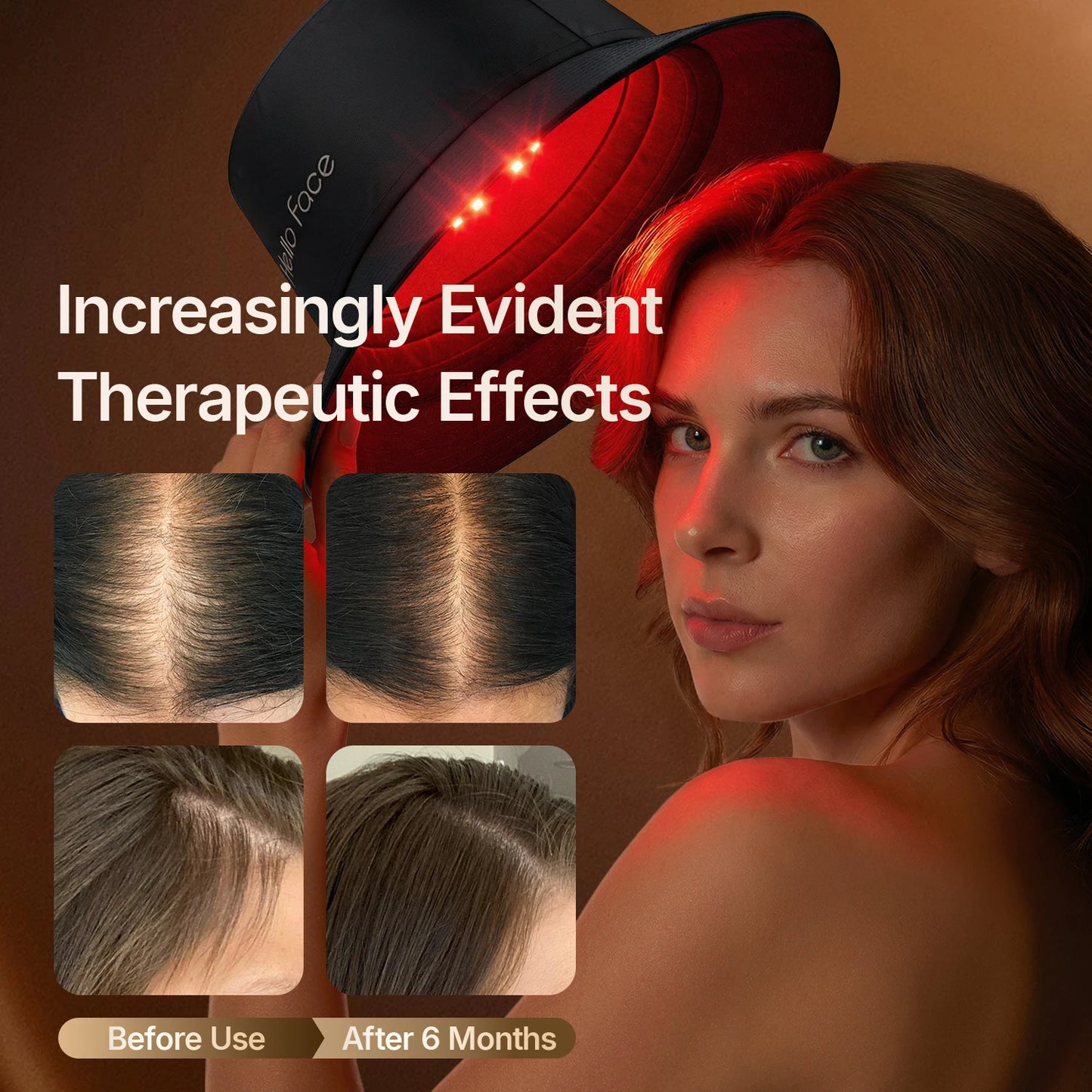 New Bucket Hat Hello Face 336 Pcs LED Hat Helmet Hair Growth Cap for Hair Loss Red Light 660nm Infrared Light 850nm Hair care