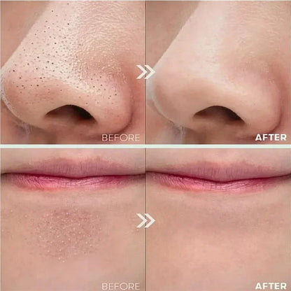 OUHOE White Black Rice Exfoliating Serum Peel Shot Facial Moisturizing Soften Blackhead Removal Hydrating Shrink Pores Skin Care Korea
