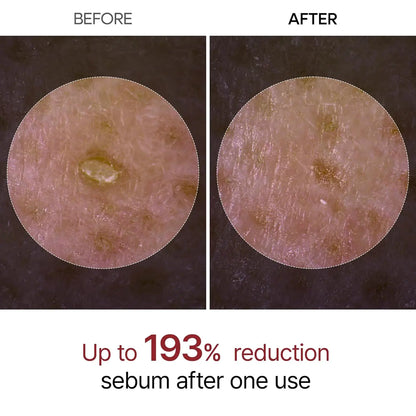Dr. Melaxin Peel Shot Glow White Rice Peeling Ampoule 80ml,Dead Skin Gentle Exfoliating Ampoule with Rice Water Extract,AHA BHA,Niacinamide