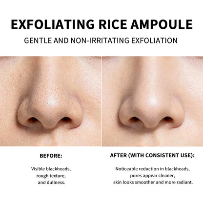 Lakrain Rice Peeling Ampoule Soft Exfoliating Face and Body Scrub Dead Skin Cells Blackhead Remover for All Skin Types  korean skin care