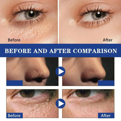 Hoygi Eye Fat Granules Removal Eyestick Anti-Puffiness Firming Cream Anti Inflammatory Fade Fine Line Repair Skin Barrier Skin Care