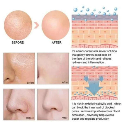 OUHOE White Black Rice Exfoliating Serum Peel Shot Facial Moisturizing Soften Blackhead Removal Hydrating Shrink Pores Skin Care Korea