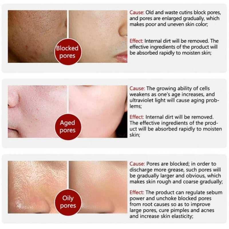 OUHOE White Black Rice Exfoliating Serum Peel Shot Facial Moisturizing Soften Blackhead Removal Hydrating Shrink Pores Skin Care Korea