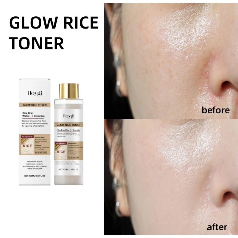 Hoygi Peel Shot Ampule Set Rice Toner Moisturizing Facial Essence Glowing Skin Water-oil Balancing Essence Revitalizing Skin Dullness