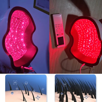 Anti Hair Loss & Scalp Care Hat, 6750mW High Power Light Therapy Cap, 210 LED 90 Laser 650/660nm for Fast Hair Growth Regrowth