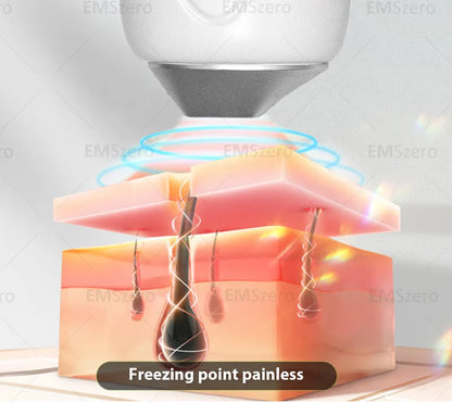 4000W Titanium Diode Laser Epilator Permanent Hair Removal Professional Laser 3 Wavelength 755 808 1064nm Painless Hair Removal