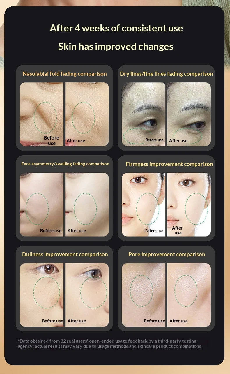 RF Facial Beauty Device EMS Anti-Aging Wrinkle Remover 2 Colors LED Skin Care Mini Radio Frequency Face Massager
