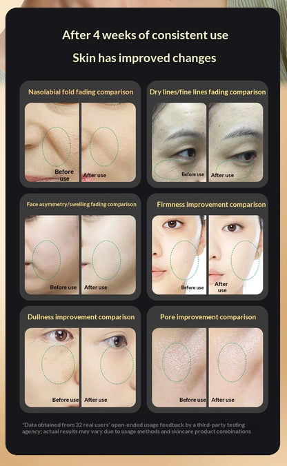 RF Facial Beauty Device EMS Anti-Aging Wrinkle Remover 2 Colors LED Skin Care Mini Radio Frequency Face Massager