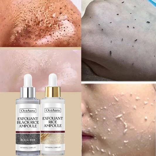 OUHOE White Black Rice Exfoliating Serum Peel Shot Facial Moisturizing Soften Blackhead Removal Hydrating Shrink Pores Skin Care Korea