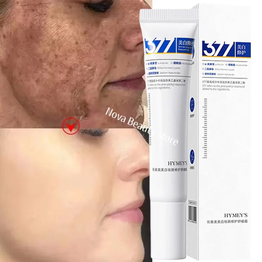 Powerful Spot-Removing Whiten Cream Brighten Skin Fast Eliminates Melanin Pigmentation Melasma Dark Spots Korean Face Skin Care