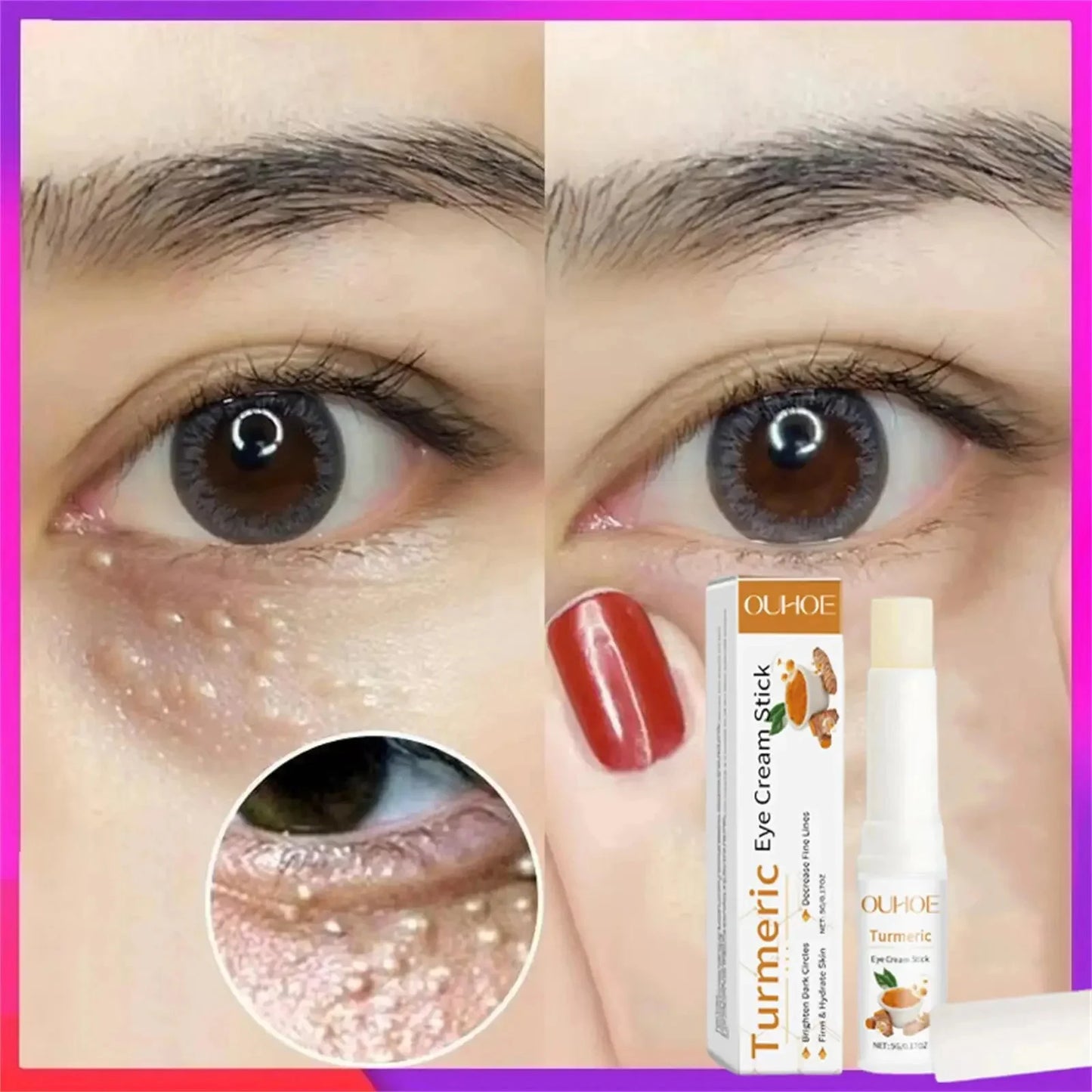 Hoygi Eye Fat Granules Removal Eyestick Anti-Puffiness Firming Cream Anti Inflammatory Fade Fine Line Repair Skin Barrier Skin Care