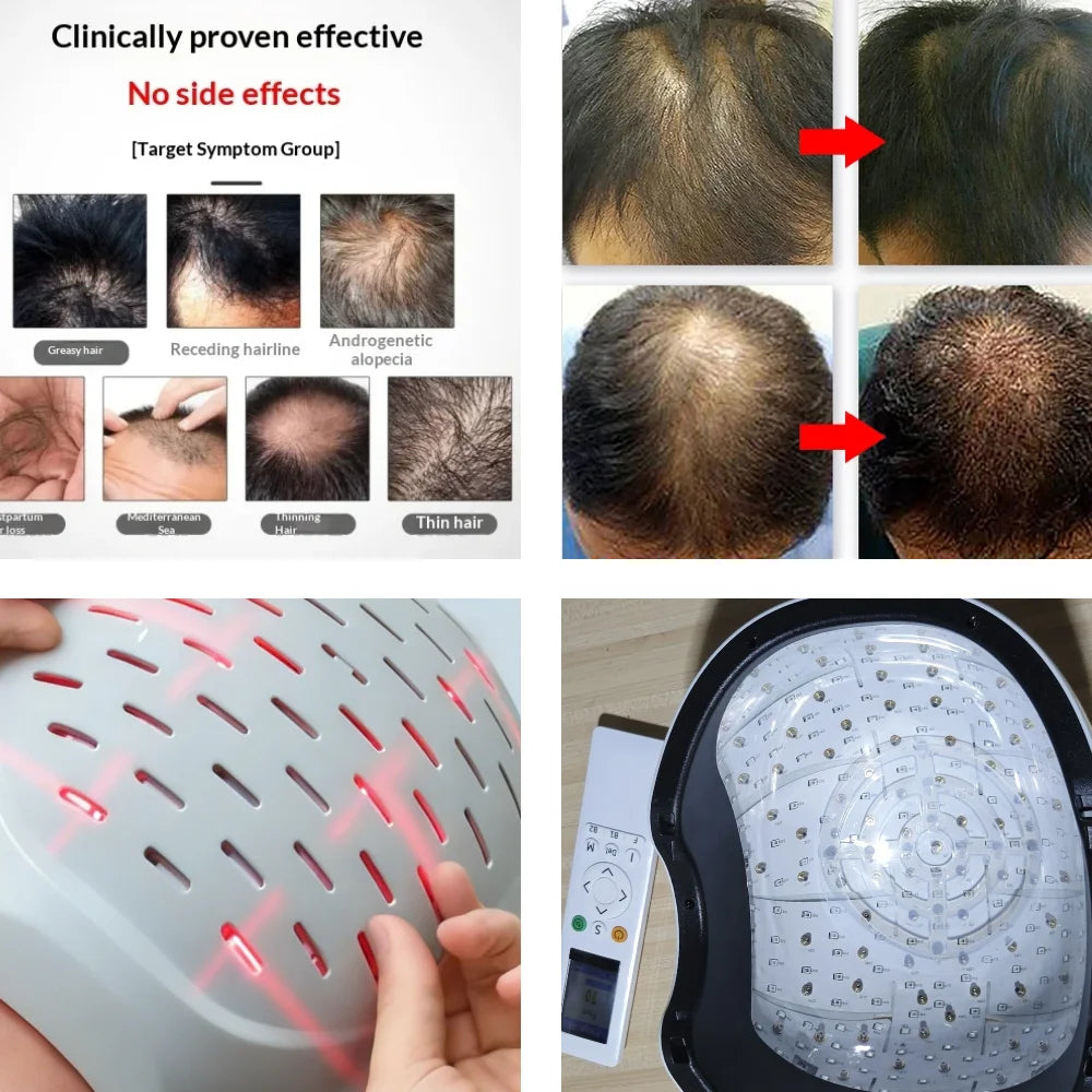 Anti Hair Loss & Scalp Care Hat, 6750mW High Power Light Therapy Cap, 210 LED 90 Laser 650/660nm for Fast Hair Growth Regrowth
