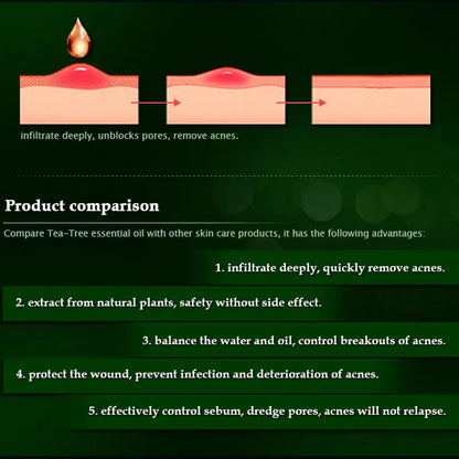 ARTISCARE pure tea tree essential oil 10mL blackhead Oil-control massage oil skin care cosmetics