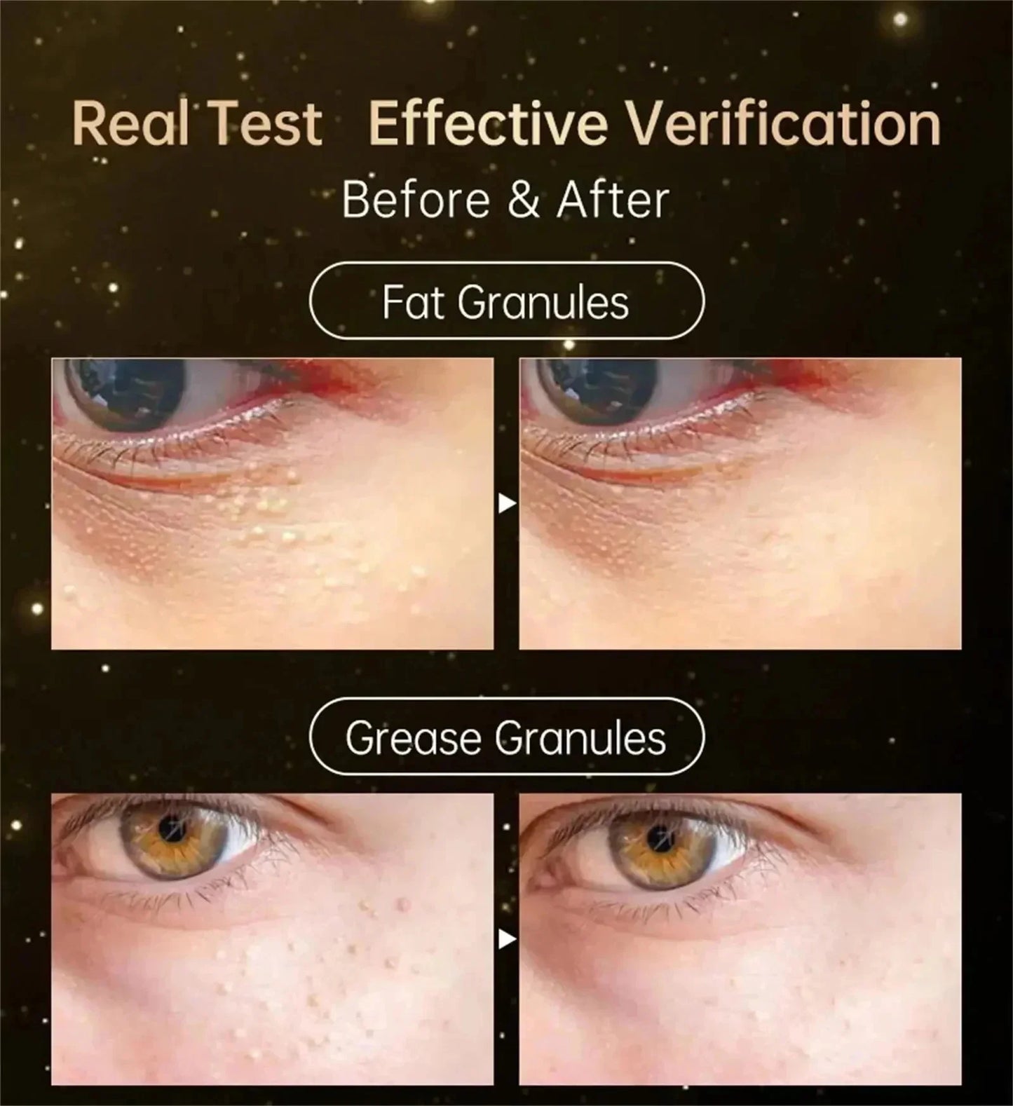 Hoygi Eye Fat Granules Removal Eyestick Anti-Puffiness Firming Cream Anti Inflammatory Fade Fine Line Repair Skin Barrier Skin Care